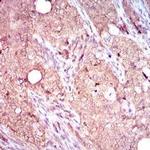 CD104 Antibody in Immunohistochemistry (Paraffin) (IHC (P))