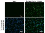 Dengue Virus Type 2 NS3 Antibody in Immunocytochemistry (ICC/IF)