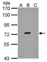 Dengue Virus Type 2 NS3 Antibody in Western Blot (WB)