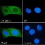 CYBA Antibody in Immunocytochemistry (ICC/IF)