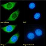 CYBA Antibody in Immunocytochemistry (ICC/IF)