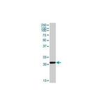 CYBA Antibody in Western Blot (WB)