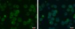 MCT1 Antibody in Immunocytochemistry (ICC/IF)