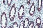 MCT1 Antibody in Immunohistochemistry (Paraffin) (IHC (P))