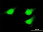 MEK5 Antibody in Immunocytochemistry (ICC/IF)