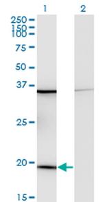 RPL17 Antibody in Western Blot (WB)