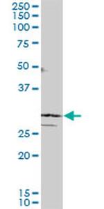 SIX3 Antibody in Western Blot (WB)