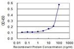 PROSC Antibody in ELISA (ELISA)