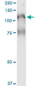 PLCL2 Antibody in Immunoprecipitation (IP)