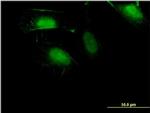 ZNF598 Antibody in Immunocytochemistry (ICC/IF)