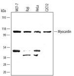 MYOCD Antibody in Western Blot (WB)