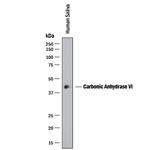 Carbonic Anhydrase VI Antibody in Western Blot (WB)