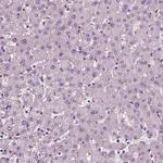 Fibulin 1 Antibody in Immunohistochemistry (IHC)