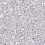 MYH6 Antibody in Immunohistochemistry (IHC)