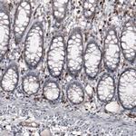 VISTA Antibody in Immunohistochemistry (IHC)