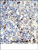 Lambda light chain Antibody in Immunohistochemistry (Paraffin) (IHC (P))