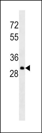 Lambda light chain Antibody in Western Blot (WB)