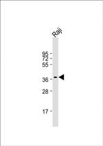 RASSF2 Antibody in Western Blot (WB)