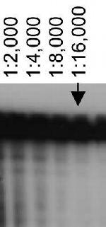 ABCA7 Antibody in Western Blot (WB)