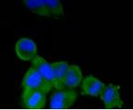 ALPL Antibody in Immunocytochemistry (ICC/IF)