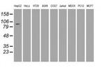 USP13 Antibody in Western Blot (WB)