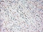 USP13 Antibody in Immunohistochemistry (Paraffin) (IHC (P))