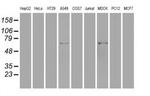 GAD67 Antibody in Western Blot (WB)