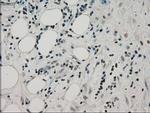 PPP1R7 Antibody in Immunohistochemistry (Paraffin) (IHC (P))