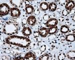 LTA4H Antibody in Immunohistochemistry (Paraffin) (IHC (P))