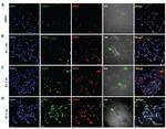 LTA4H Antibody in Immunohistochemistry (IHC)