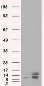 Profilin 1 Antibody in Western Blot (WB)