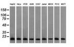 Profilin 1 Antibody in Western Blot (WB)