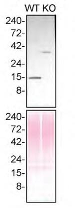 Profilin 1 Antibody