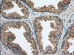 RAB17 Antibody in Immunohistochemistry (Paraffin) (IHC (P))