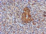 CYB5R3 Antibody in Immunohistochemistry (Paraffin) (IHC (P))