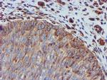 CYB5R3 Antibody in Immunohistochemistry (Paraffin) (IHC (P))