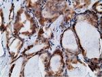 KHK Antibody in Immunohistochemistry (Paraffin) (IHC (P))