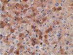 KHK Antibody in Immunohistochemistry (Paraffin) (IHC (P))