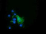 EPHX2 Antibody in Immunocytochemistry (ICC/IF)