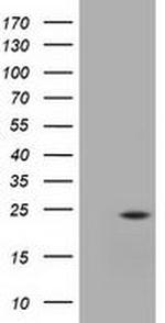 UBE2T Antibody in Western Blot (WB)