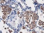 PEPD Antibody in Immunohistochemistry (Paraffin) (IHC (P))