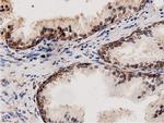 Adenylate Kinase 5 Antibody in Immunohistochemistry (Paraffin) (IHC (P))