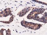 Adenylate Kinase 5 Antibody in Immunohistochemistry (Paraffin) (IHC (P))