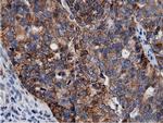 Adenylate Kinase 5 Antibody in Immunohistochemistry (Paraffin) (IHC (P))