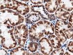 Adenylate Kinase 5 Antibody in Immunohistochemistry (Paraffin) (IHC (P))