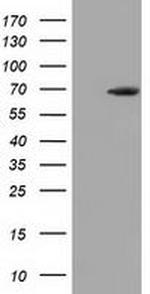 EPM2AIP1 Antibody in Western Blot (WB)