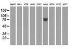 EPM2AIP1 Antibody in Western Blot (WB)