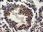 ADSL Antibody in Immunohistochemistry (Paraffin) (IHC (P))