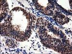 ADSL Antibody in Immunohistochemistry (Paraffin) (IHC (P))