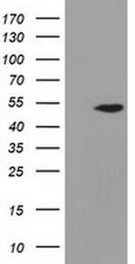 ADSL Antibody in Western Blot (WB)